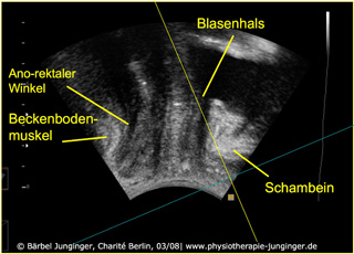 Ultraschall des Beckenbodens foto ultraschall 1
